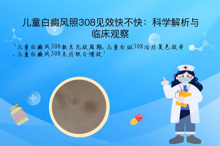 儿童白癜风照308见效快不快：科学解析与临床观察