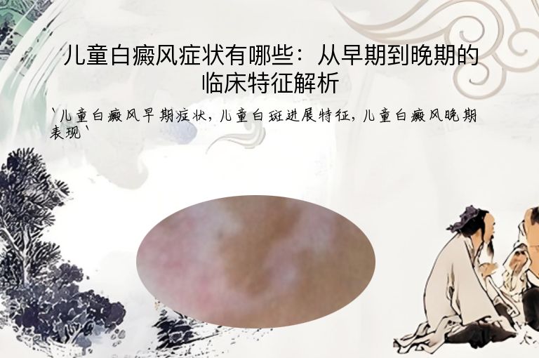 儿童白癜风症状有哪些：从早期到晚期的临床特征解析