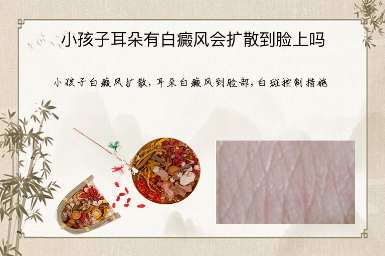 小孩子耳朵有白癜风会扩散到脸上吗”