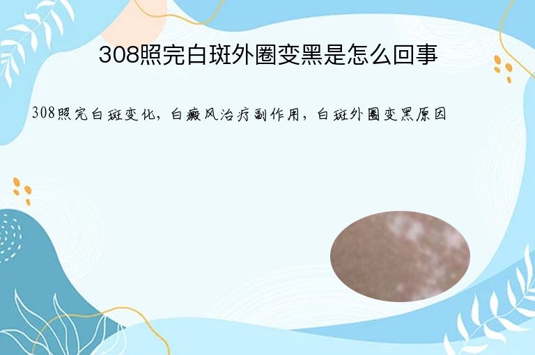 308照完白斑外圈变黑是怎么回事”