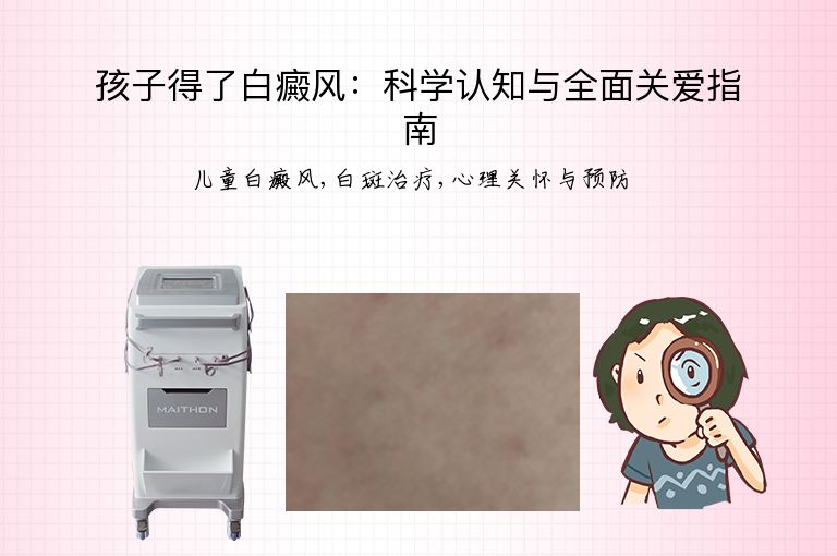 孩子得了白癜风:科学认知与全面关爱指南”