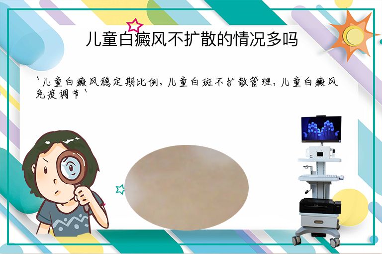 https://www.bdfsjzyy.com/d/file/p/ae3d0e72a389a1569f7da40cb38fa80b.jpeg