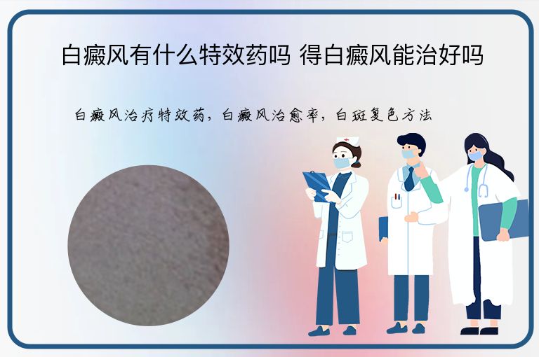 白癜风有什么特效药吗 得白癜风能治好吗”