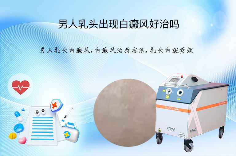 男人乳头出现白癜风好治吗”