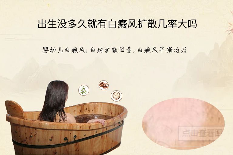 https://www.bdfsjzyy.com/d/file/p/1dc557e2c735c78b0a8139eefeaec2b0.jpeg