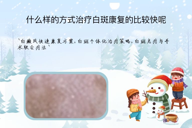 什么样的方式治疗白斑康复的比较快呢