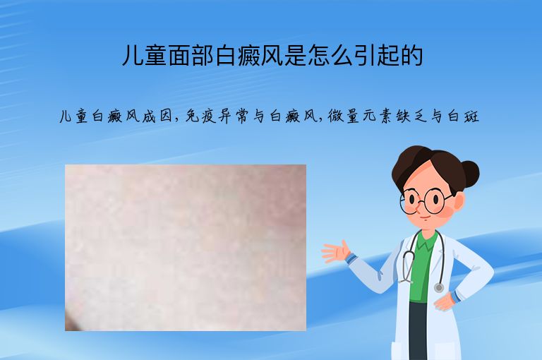 儿童面部白癜风是怎么引起的”