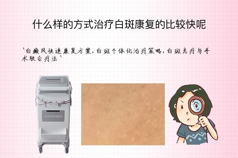 什么样的方式治疗白斑康复的比较快呢