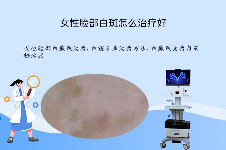 女性脸部白斑怎么治疗好”