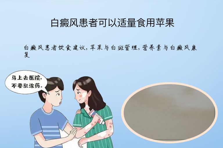 白癜风患者可以适量食用苹果”