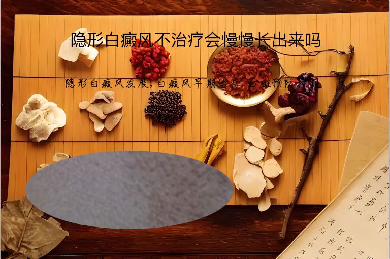 隐形白癜风不治疗会慢慢长出来吗”