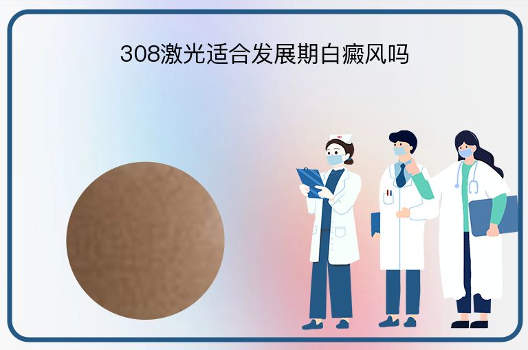308激光适合发展期白癜风吗”