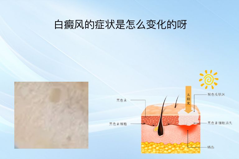 https://www.bdfsjzyy.com/d/file/p/bdc1ebb2da915f57a1565a2522663759.jpeg