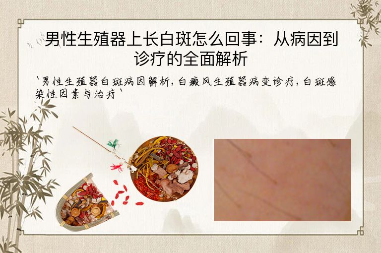 男性生殖器上长白斑怎么回事：从病因到诊疗的全面解析
