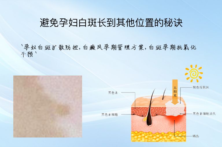 https://www.bdfsjzyy.com/d/file/p/83979ab5e6c09d74c5a0d5c807efeb28.jpeg