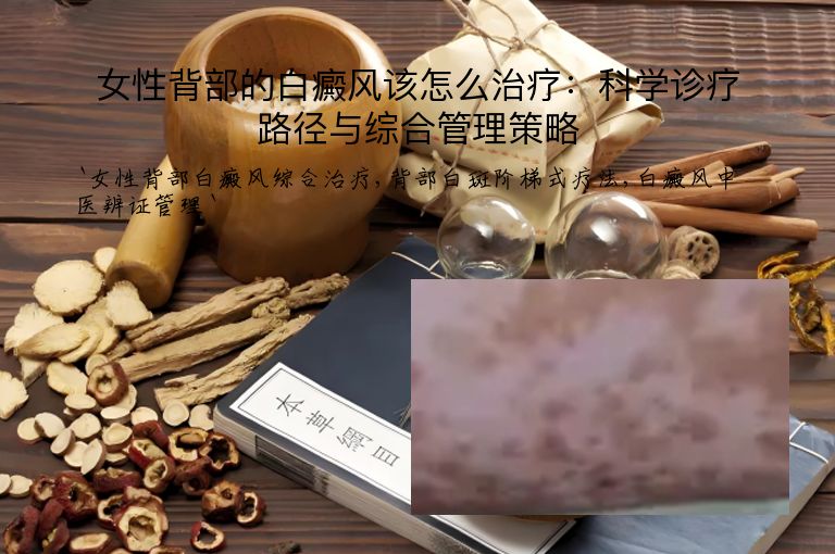 女性背部的白癜风该怎么治疗：科学诊疗路径与综合管理策略