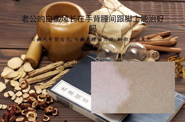 老公的白癜风长在手背腰间跟脚上能治好吗”