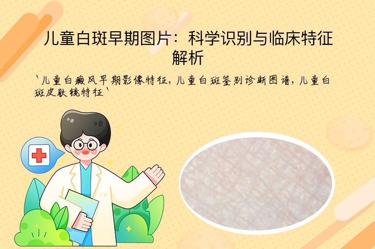 儿童白斑早期图片：科学识别与临床特征解析