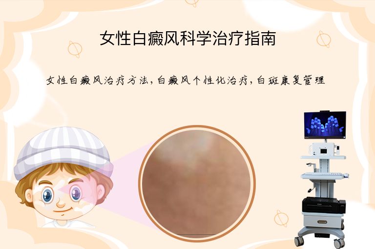 女性白癜风科学治疗指南”