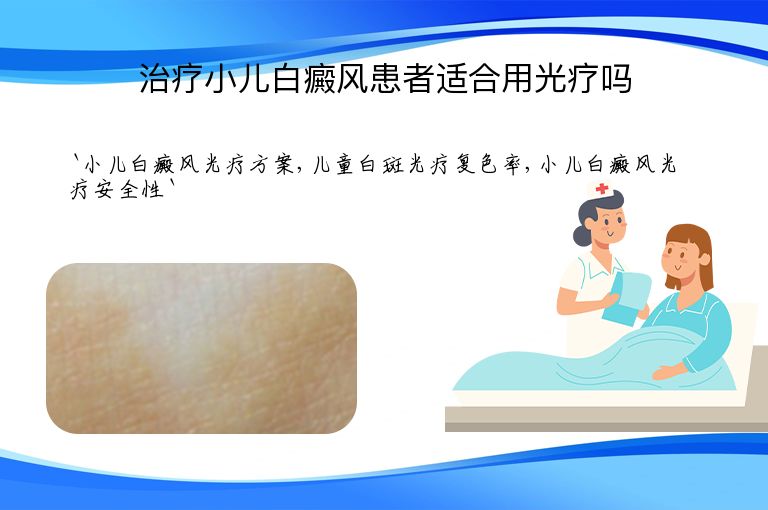 治疗小儿白癜风患者适合用光疗吗