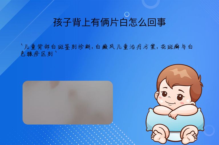 孩子背上有俩片白怎么回事