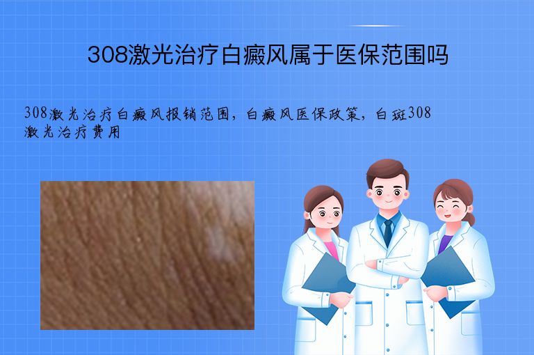 308激光治疗白癜风属于医保范围吗”