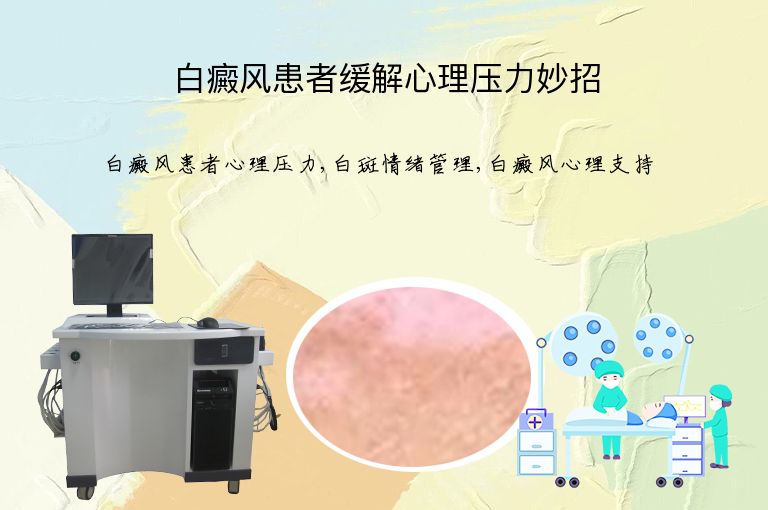 https://www.bdfsjzyy.com/d/file/p/a7aea36769259b0c39e5b736e01fb811.jpeg