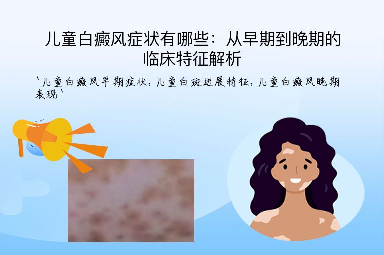 儿童白癜风症状有哪些:从早期到晚期的临床特征解析