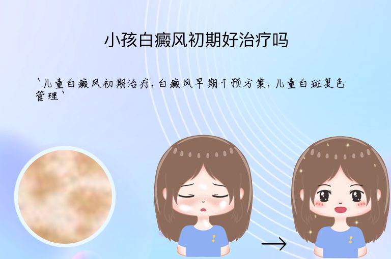 小孩白癜风初期好治疗吗