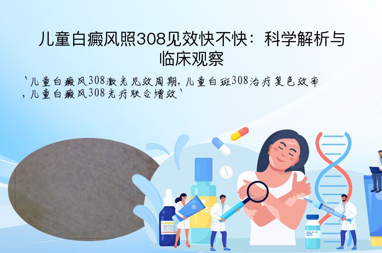 儿童白癜风照308见效快不快:科学解析与临床观察