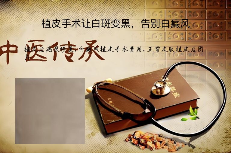 植皮手术让白斑变黑，告别白癜风”