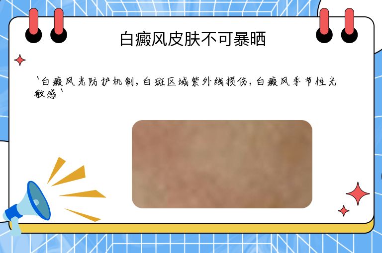 白癜风皮肤不可暴晒