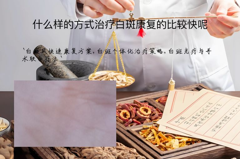 什么样的方式治疗白斑康复的比较快呢