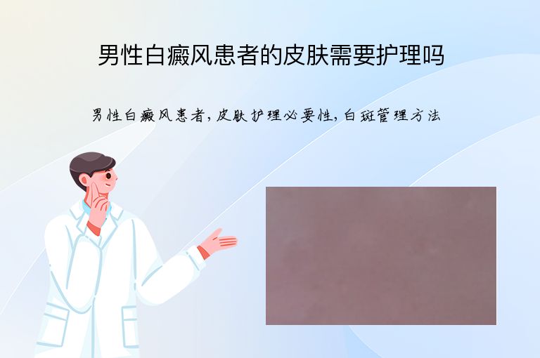 男性白癜风患者的皮肤需要护理吗”