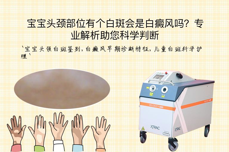 宝宝头颈部位有个白斑会是白癜风吗？专业解析助您科学判断”