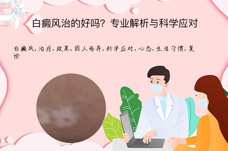 白癜风治的好吗?专业解析与科学应对”