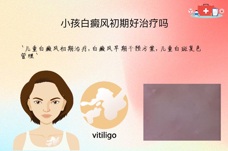 小孩白癜风初期好治疗吗