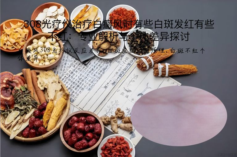308光疗仪治疗白癜风时有些白斑发红有些不红:专业解析与个体差异探讨”