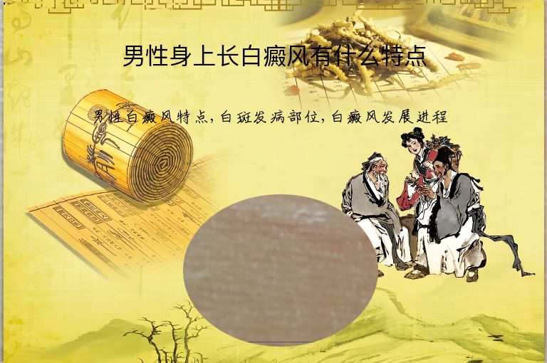 https://www.bdfsjzyy.com/d/file/p/6933f4c3e91c0904f3d4160e43396a1b.jpeg