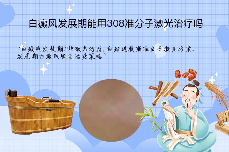 白癜风发展期能用308准分子激光治疗吗”