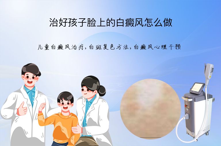 治好孩子脸上的白癜风怎么做”