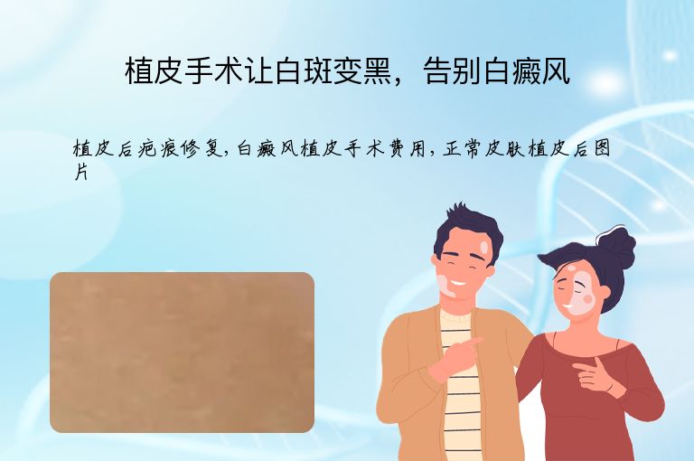 植皮手术让白斑变黑，告别白癜风”