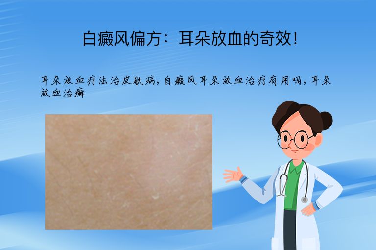 白癜风偏方：耳朵放血的奇效！”