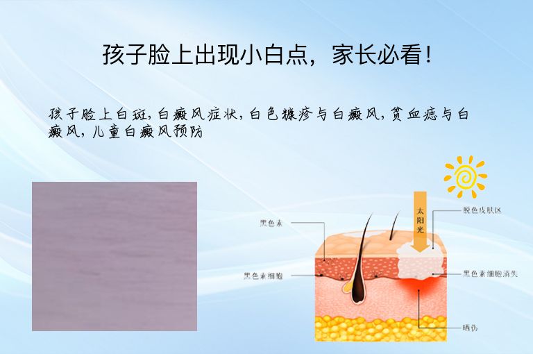 孩子脸上出现小白点，家长必看！”