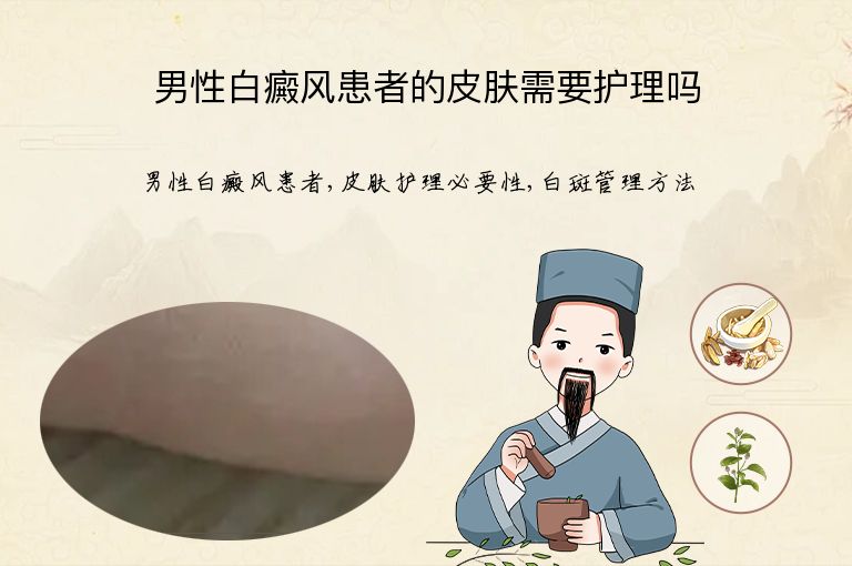 男性白癜风患者的皮肤需要护理吗”