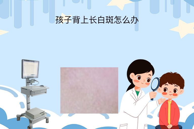 孩子背上长白斑怎么办”