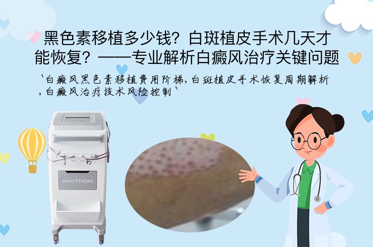 黑色素移植多少钱?白斑植皮手术几天才能恢复?——专业解析白癜风治疗关键问题”
