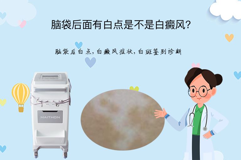 脑袋后面有白点是不是白癜风？”