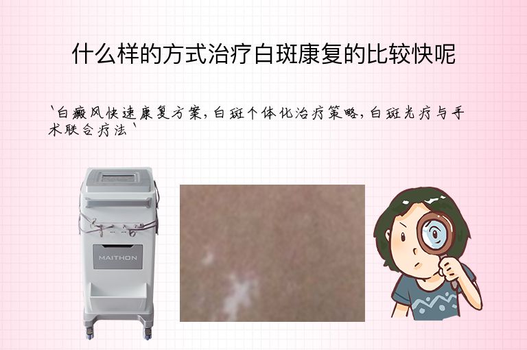 什么样的方式治疗白斑康复的比较快呢