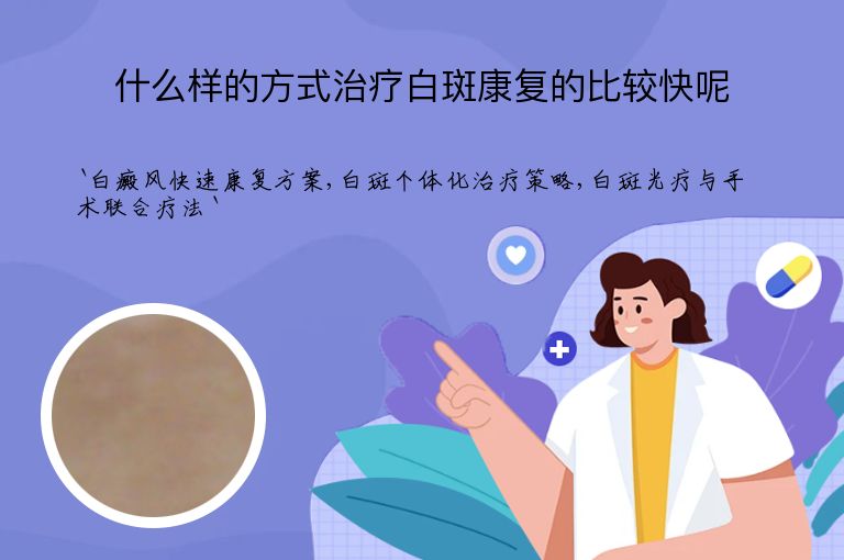 什么样的方式治疗白斑康复的比较快呢